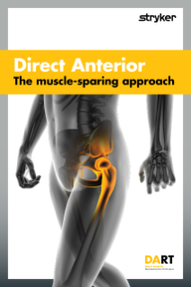DART™ brochure - The muscle-sparing approach