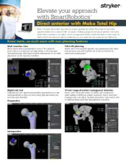 Elevate your approach with SmartRobotics - Direct anterior with Mako Total Hip