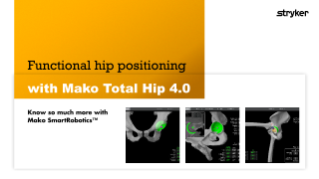 Mako Total Hip 4.0 pre-planning guide