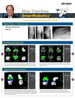 Mako Total Knee SmartRobotics™ - Case review with Dr. Kirby Hitt