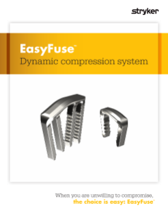 EasyFuse® Dynamic compression system brochure