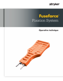 FuseForce Fixation System | Operative Technique