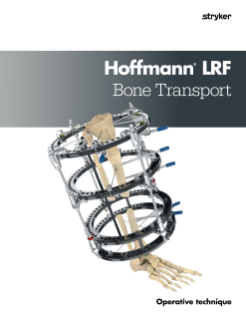 Hoffmann LRF Bone Transport | operative technique 