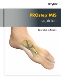 PROstep MIS Lapidus operative technique 