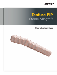 Tenfuse PIP Sterile Allograft | Operative Technique