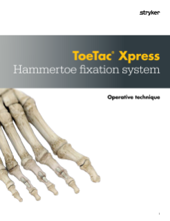 ToeTac Xpress | Operative Technique