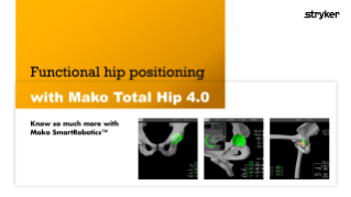 Functional hip positioning with Mako Total Hip 4.0