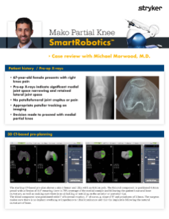 Mako Partial Knee SmartRobotics™ - Case review with Michael Morwood, M.D. 