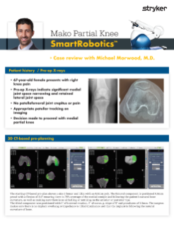 Mako Partial Knee SmartRobotics™ - Case review with Michael Morwood, M.D.