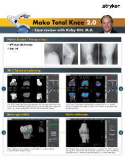 Mako Total Knee 2.0 – Case review with Kirby Hitt, M.D.