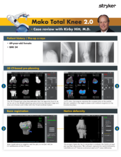 Mako Total Knee 2.0 - Case review with Kirby Hitt.pdf